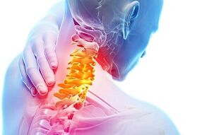 Sintomi di osteocondosi del collo e regole nutrizionali per le malattie